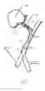 Fig. 09 - Method and device for canulation and occlusion of uterine arteries