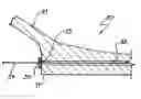 Fig. 01 - Method and apparatus for sealing a lumen in an electrode assembly