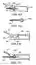 Fig. 09 - Method and apparatus for sealing a lumen in an electrode assembly