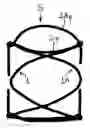Fig. 01 - External support for restoring competence to venous valves by traction of their intercommissural walls