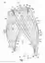 Fig. 02 - Venous valve apparatus, system, and method