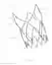 Fig. 09 - Advanced endovascular graft