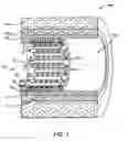 Fig. 02 - Expandable medical device and method for treating chronic total occlusions with local delivery of an angiogenic factor