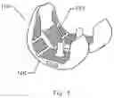 Fig. 02 - Implant with composite coating
