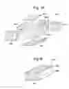 Fig. 06 - Compound bone structure of allograft tissue with threaded fasteners