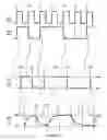 Fig. 03 - Signal drive de-emphasis control for serial bus