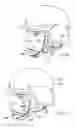 Fig. 02 - Headset-accommodating, load-balancing, helmet strap system