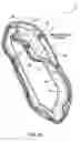 Fig. 09 - Tube hat
