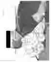 Fig. 07 - Apparatus and method to position a patient for airway management and endotracheal intubation