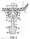 Fig. 04 - Detachable cleat system
