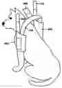 Fig. 01 - Elbow pads for dogs