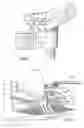 Fig. 03 - Cutting tool and system for coring a bowl using a lathe