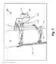 Fig. 08 - Temporary arm gain and saddle