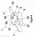 Fig. 07 - Chemical reactor clamp