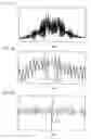 Fig. 09 - Position measuring system with a scanning unit having a reference pulse signal detection unit