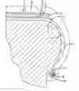 Fig. 01 - Method of molding a tire