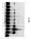Fig. 49 - FEN endonucleases