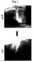 Fig. 02 - Remedy for ischemia