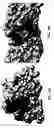 Fig. 10 - Compositions and methods for treating amyotrophic lateral sclerosis (ALS)