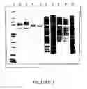 Fig. 02 - Alkyl phosphine detergent products and extraction processes