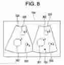 Fig. 09 - Ultrasonic imaging apparatus