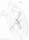 Fig. 02 - Urine sample collection device
