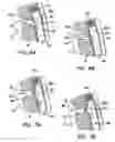 Fig. 06 - Methods and apparatus for transmyocardial direct coronary revascularization