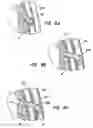 Fig. 07 - Methods and apparatus for transmyocardial direct coronary revascularization