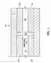 Fig. 02 - Liquefaction handpiece