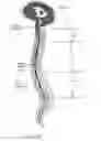 Fig. 02 - Subarachnoid spinal catheter for transporting cerebrospinal fluid