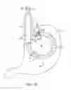 Fig. 02 - Flexible shaft system having interchangeable end effectors