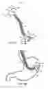 Fig. 08 - Flexible shaft system having interchangeable end effectors