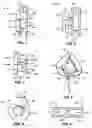 Fig. 02 - Suture retainer with suture guide and method of using a suture retainer with a suture guide