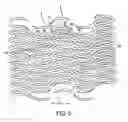 Fig. 06 - Methods and apparatus for curved stent