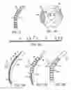 Fig. 12 - Methods and apparatus for curved stent