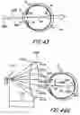 Fig. 09 - System and method for aligning an optic with an axis of an eye