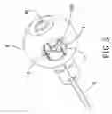 Fig. 06 - Door lock assembly having a press button in an inner handle
