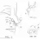 Fig. 02 - Internal nasal dilator and medicine delivery method
