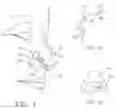 Fig. 02 - Internal nasal dilator and medicine delivery method