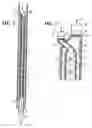 Fig. 02 - Hydrocyclone for down-hole use