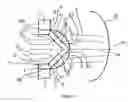 Fig. 04 - Vision enhancing device