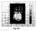 Fig. 07 - Relative calibration for dosimetric devices