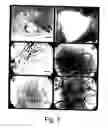 Fig. 06 - Prevascularized constructs for implantation to provide blood perfusion