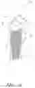 Fig. 02 - Dental implant system