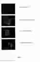 Fig. 06 - Methods for treating ocular angiogenesis, retinal edema, retinal ischemia, and diabetic retinopathy using selective RTK inhibitors