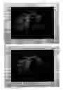 Fig. 07 - Systems and methods of 3 dimensional ultrasonic imaging of hard tissue
