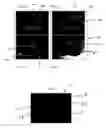 Fig. 04 - Load relieving wound dressing