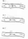 Fig. 02 - Catheter device