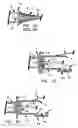 Fig. 24 - Needle tip guard for percutaneous entry needles