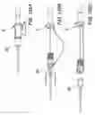 Fig. 44 - Needle tip guard for percutaneous entry needles